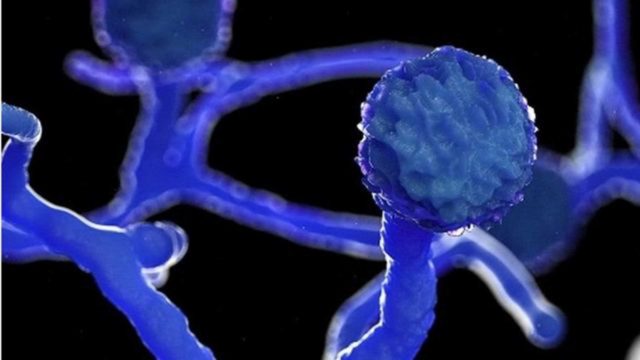 Se confirma en Honduras el primer caso de hongo negro o mucormicosis